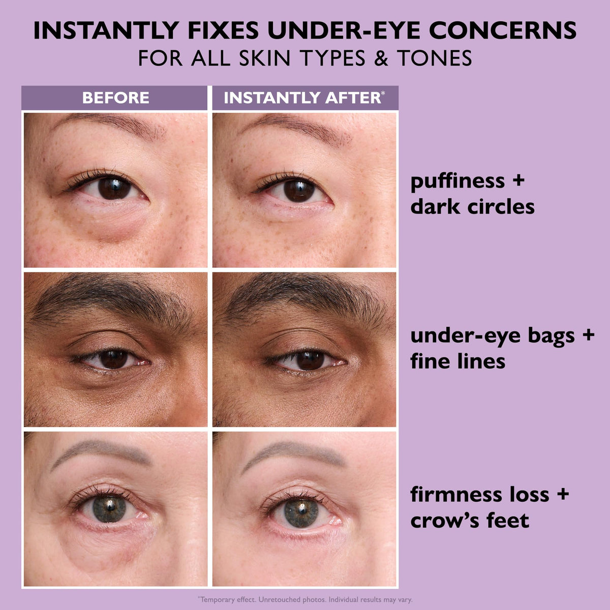 Peter Thomas Roth | Instant FIRMx® Eye Temporary Eye Tightener Easy-Wear Formula | For Firming Under-Eye Bags & Wrinkles Peter Thomas Roth