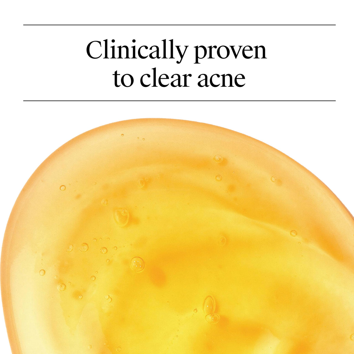 Neutrogena Oil Free Acne Face Wash, 9.1 fl. oz, 3 Pack Neutrogena