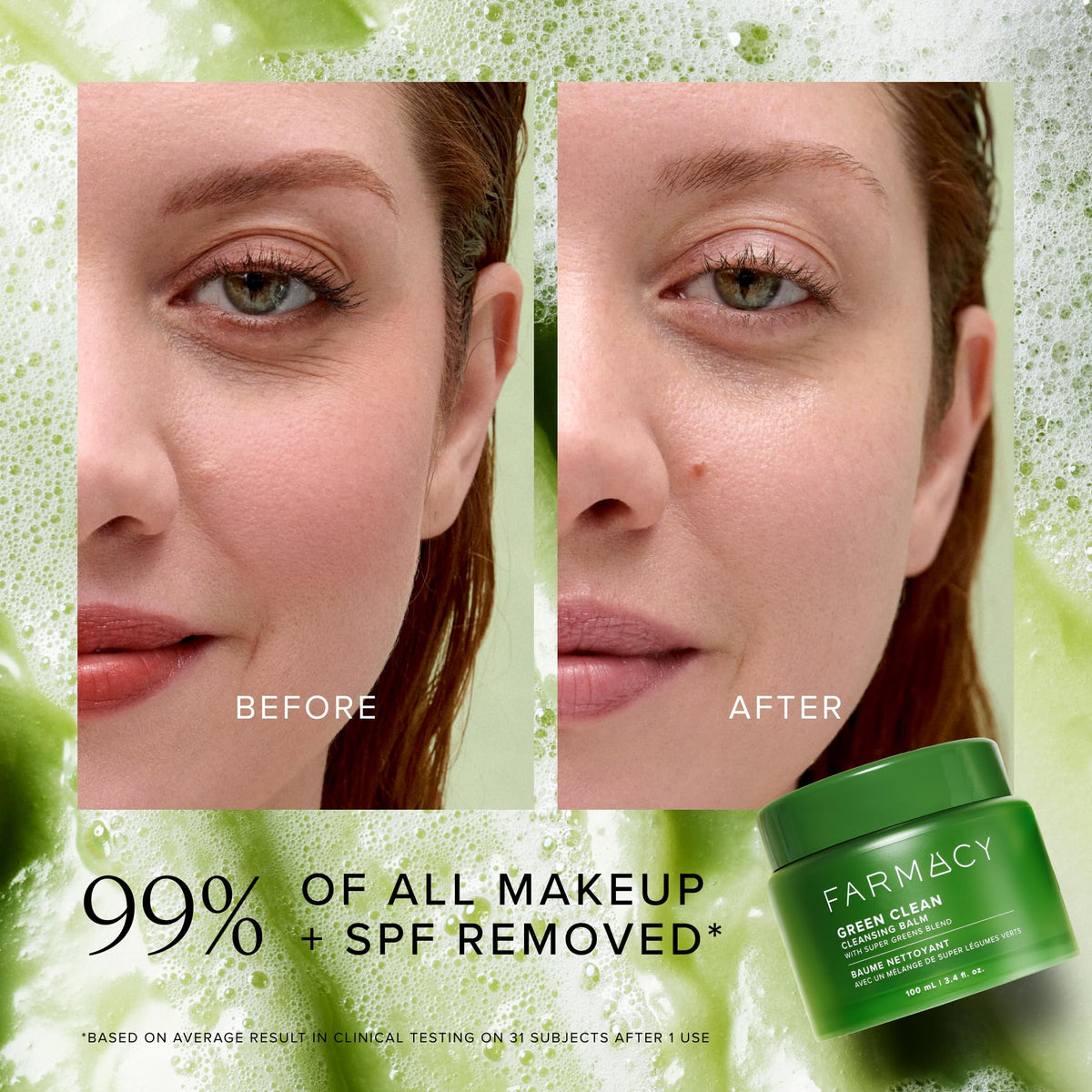 Farmacy Makeup Remover Cleansing Balm - Green Clean Waterproof Makeup Remover Balm + Oil Cleanser for Face - Gently Melts Make Up + SPF - Hydrates + Softens Skin with Super Greens + Papaya (200ml) Farmacy