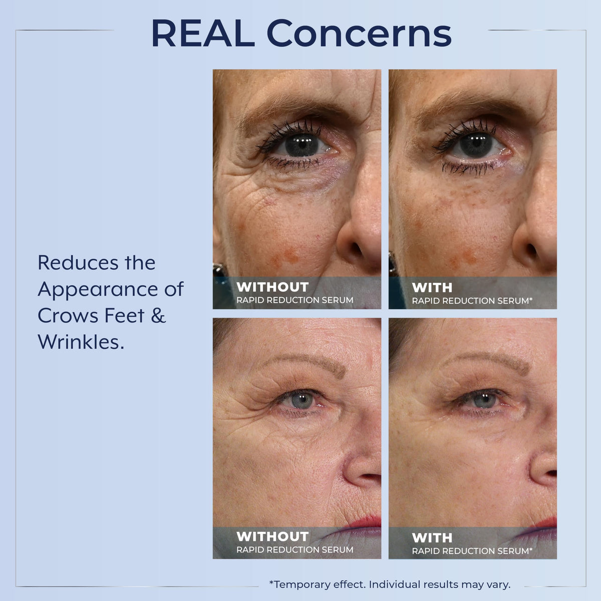 Plexaderm Eye Serum Pump - Visibly Reduces Bags, Wrinkles & Dark Circles Plexaderm