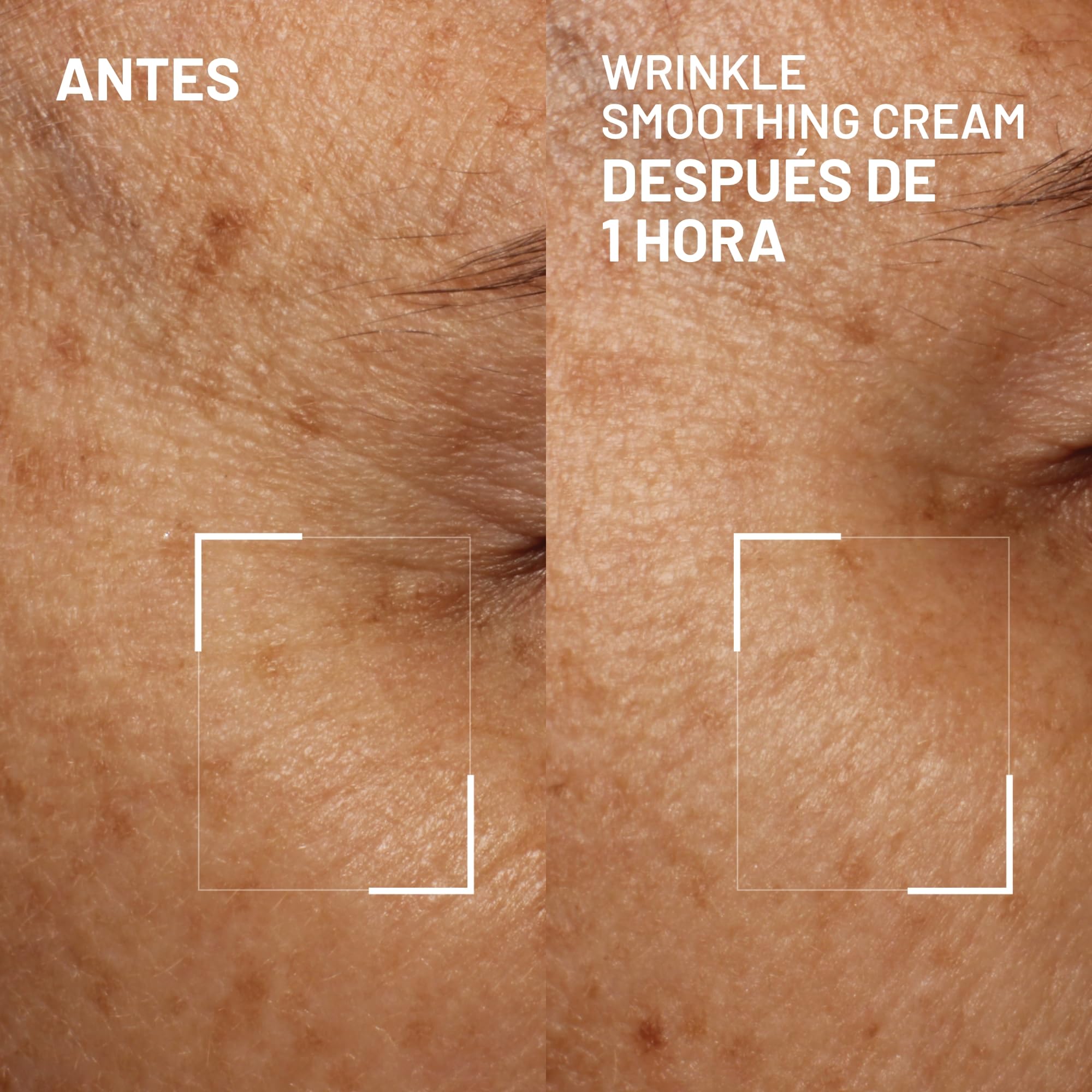 Dr. Brandt Needles No More Wrinkle Smoothing Cream - Smooths Expression Lines, Firms & Protects the Skin - 0.5 oz Dr. Brandt Skincare buy australia supplements