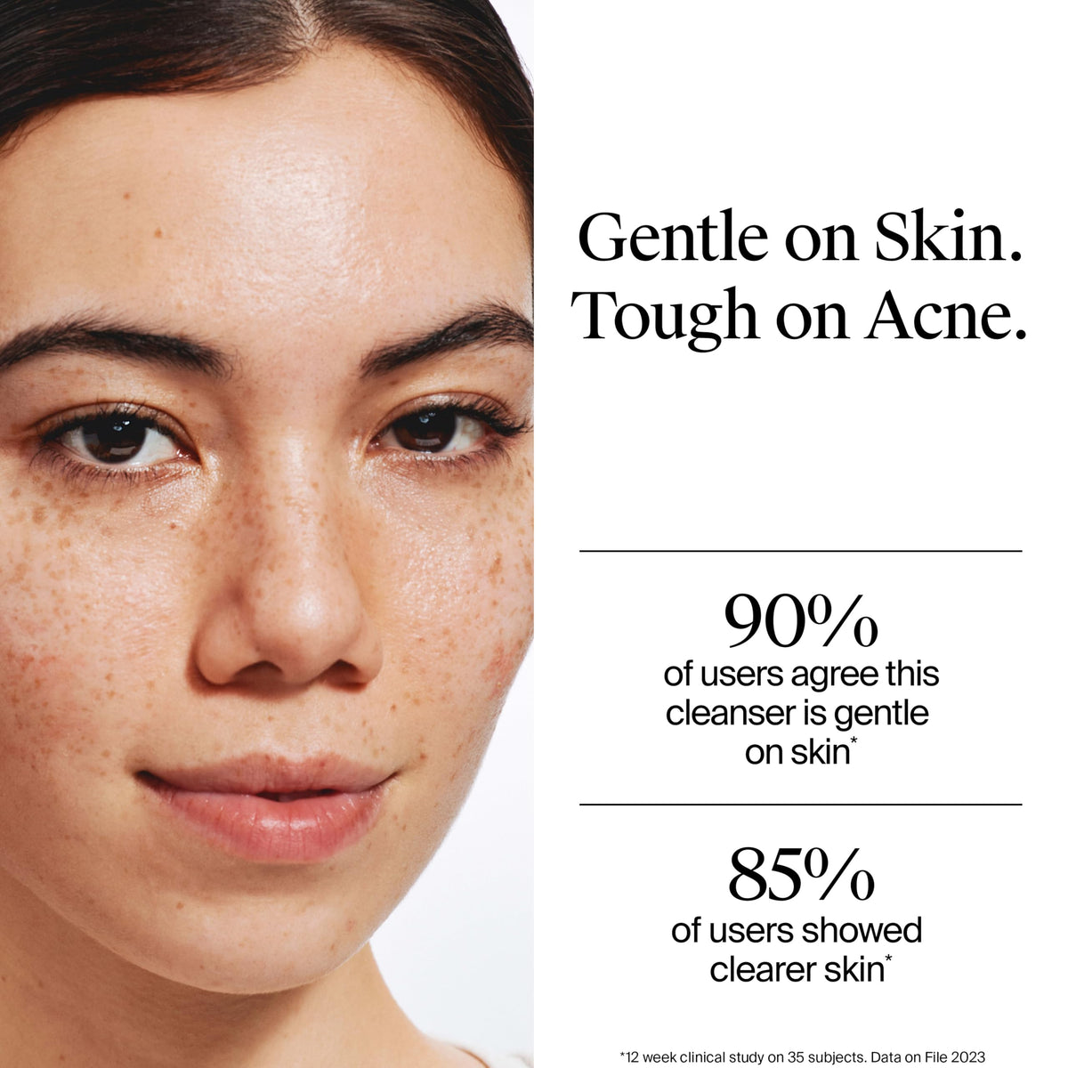 Neutrogena Oil Free Acne Face Wash, 9.1 fl. oz Neutrogena