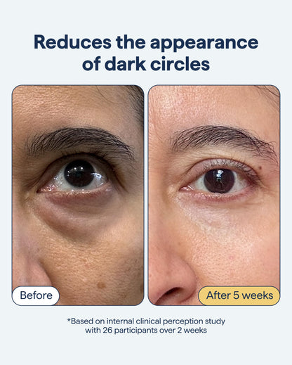 REMEDY Dark Circles Reducing Advanced Eye Cream with Caffeine, Niacinamide, Remedy Science