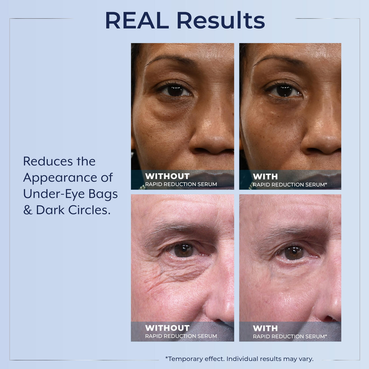 Plexaderm Eye Serum Pump - Visibly Reduces Bags, Wrinkles & Dark Circles Plexaderm
