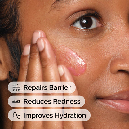 The Ordinary Soothing & Barrier Support Serum, Redness-Reducing & Hydrating Solution with Centella Asiatica for Skin Barrier Repair, 1 Fl Oz The Ordinary