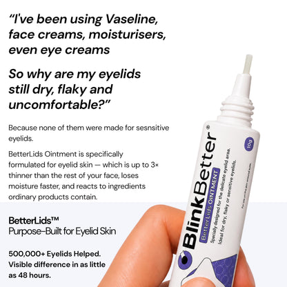 BlinkBetter BetterLids Eyelid Ointment for Dry, Itchy & Sensitive Eyelids – Deep-Moisturising Oat Complex with Shea Butter & Panthenol to Hydrate, Nourish & Soothe Delicate Eyelid Skin – 0.34 oz BlinkBetter