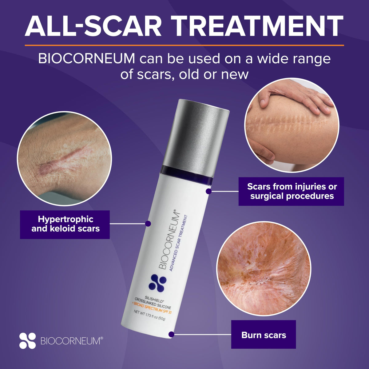 Biocorneum Silicone Scar Gel with SPF 30, Fast-Drying Scar Cream, 10g BIOCORNEUM