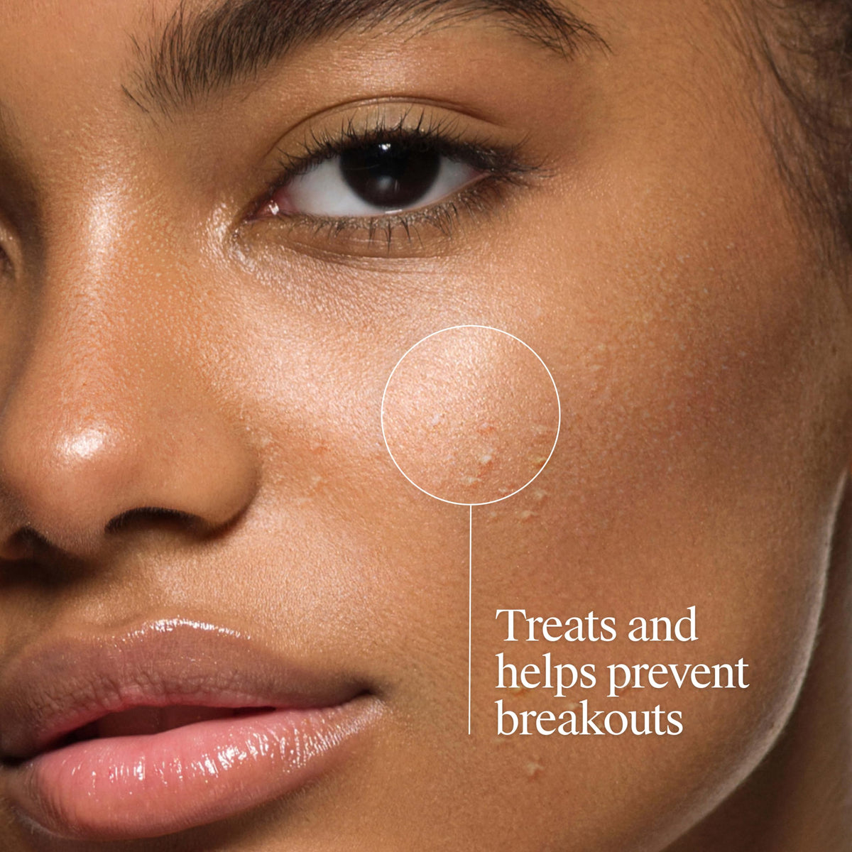 Neutrogena Oil Free Acne Face Wash, Fragrance Free, 9.1 fl oz Neutrogena