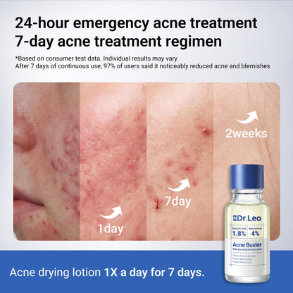 Dr.Leo 1.8% Salicylic Acid Acne Spot Treatment Drying Lotion, 0.34oz Dr.Leo