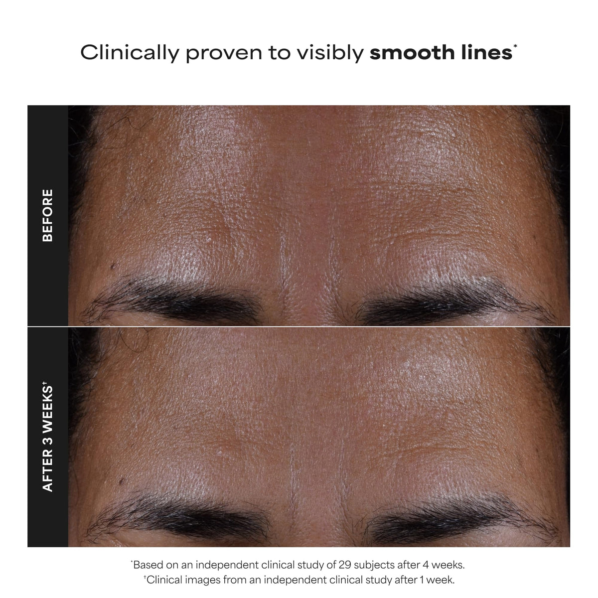Paula's Choice SKIN PERFECTING 2% BHA Liquid Exfoliant, 4 Fl Oz Paula's Choice
