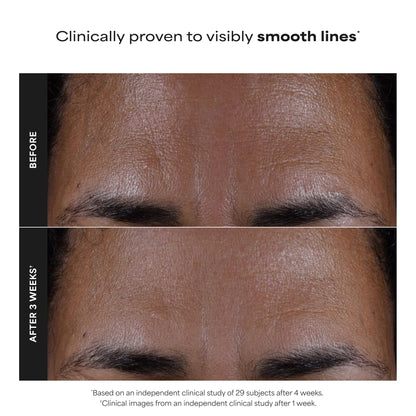 Paula's Choice SKIN PERFECTING 2% BHA Liquid Exfoliant, 4 Fl Oz Paula's Choice