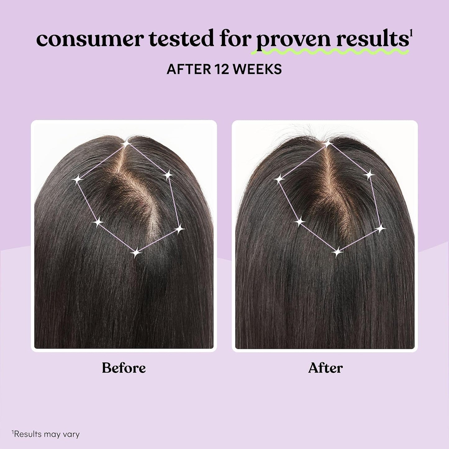 Lemme Grow Hair Growth Capsules for Women, Clinically Studied Keratin Complex, Visibly Thicker Hair & Reduced Shedding, Nourish Thinning Hair, Biotin-Free, 30 Count, 30-Day Supply