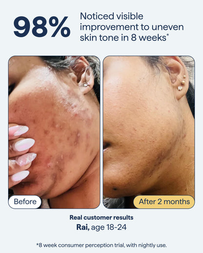 Remedy for Dark Spots | Advanced Night Treatment with Retinol & Kojic Acid | For Discoloration and Uneven Tones | With Glutathione Remedy Science