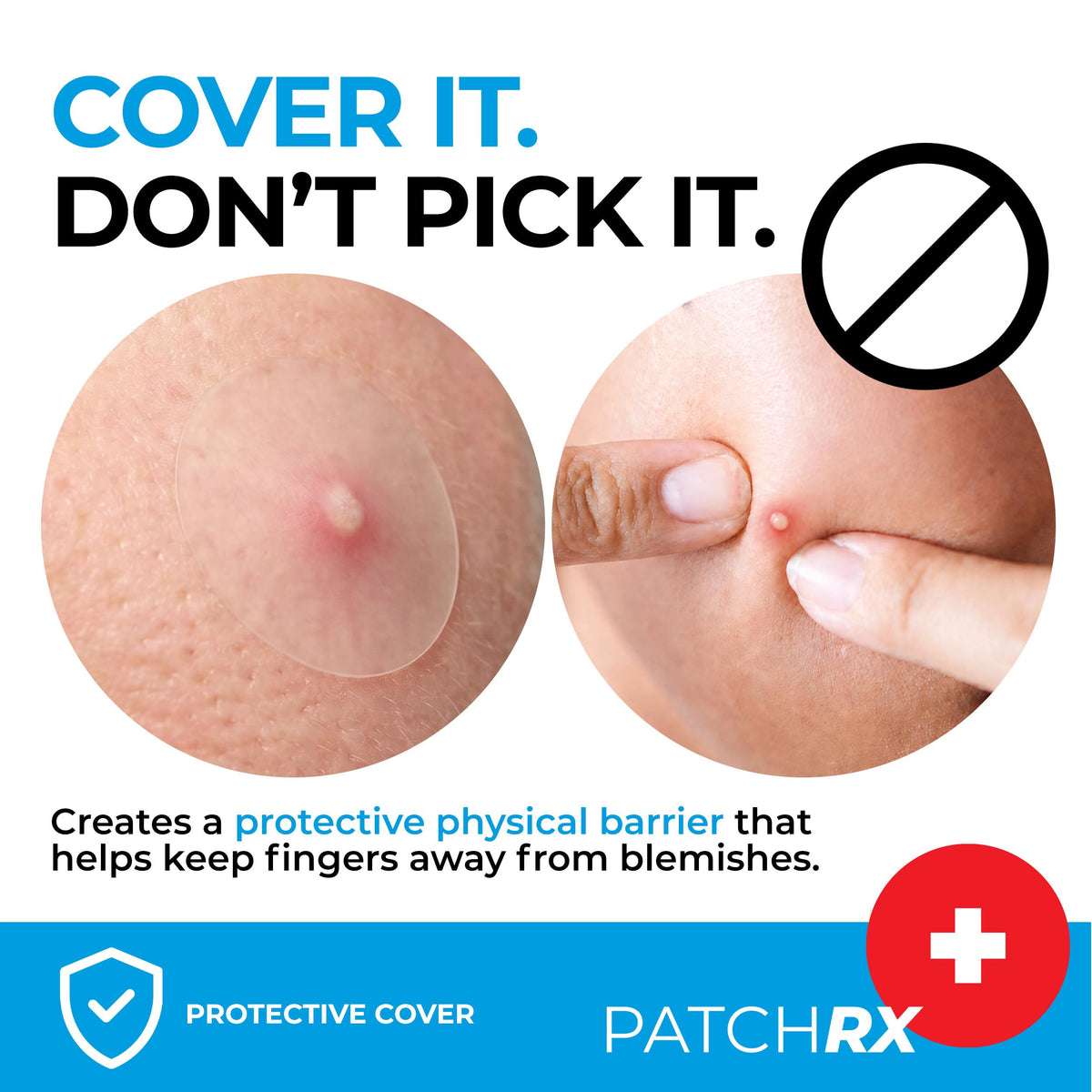 PatchRx Pimple Patches for Face (120 Patches), Hydrocolloid Acne Patches with Tea Tree Oil, Pimple Patch Pimple Stickers - Hydrocolloid Patch Acne Dots - Acne Pimple Patches For Face - Zit Patches PatchRx
