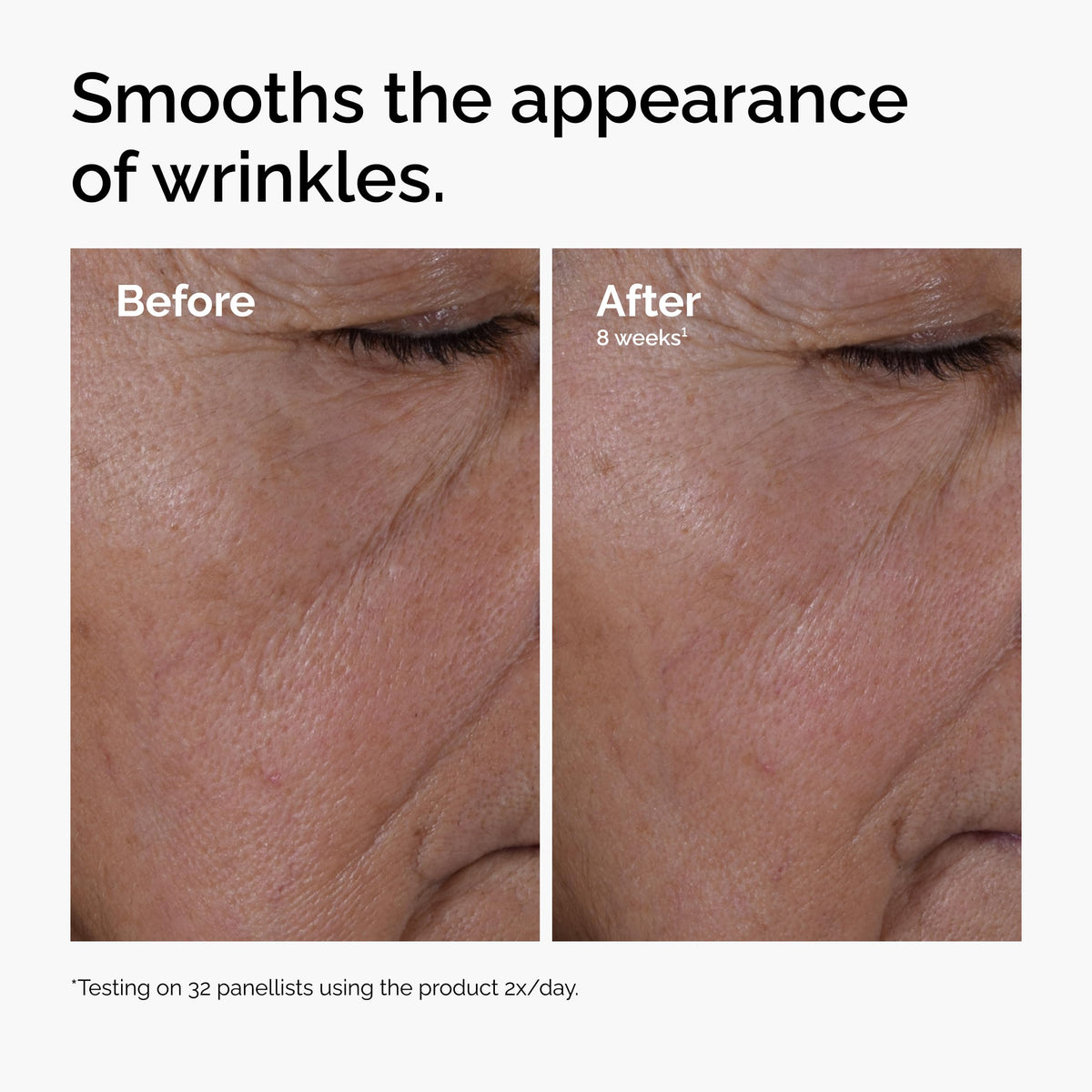 The Ordinary Multi-Peptide + Hyaluronic Acid, Anti-Aging Peptide Serum for Crow’s Feet, Elasticity & Firmness, 1 Fl Oz The Ordinary