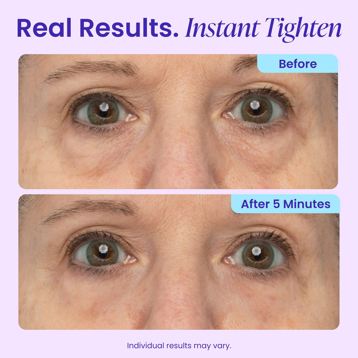 goPure NEW Instant Lift Eye Gel - To Imrove the look of Eye Bags, Wrinkles, Fine Lines and Dark Circles, Anti Aging Skin Care with MaxLift3 Biotech goPure