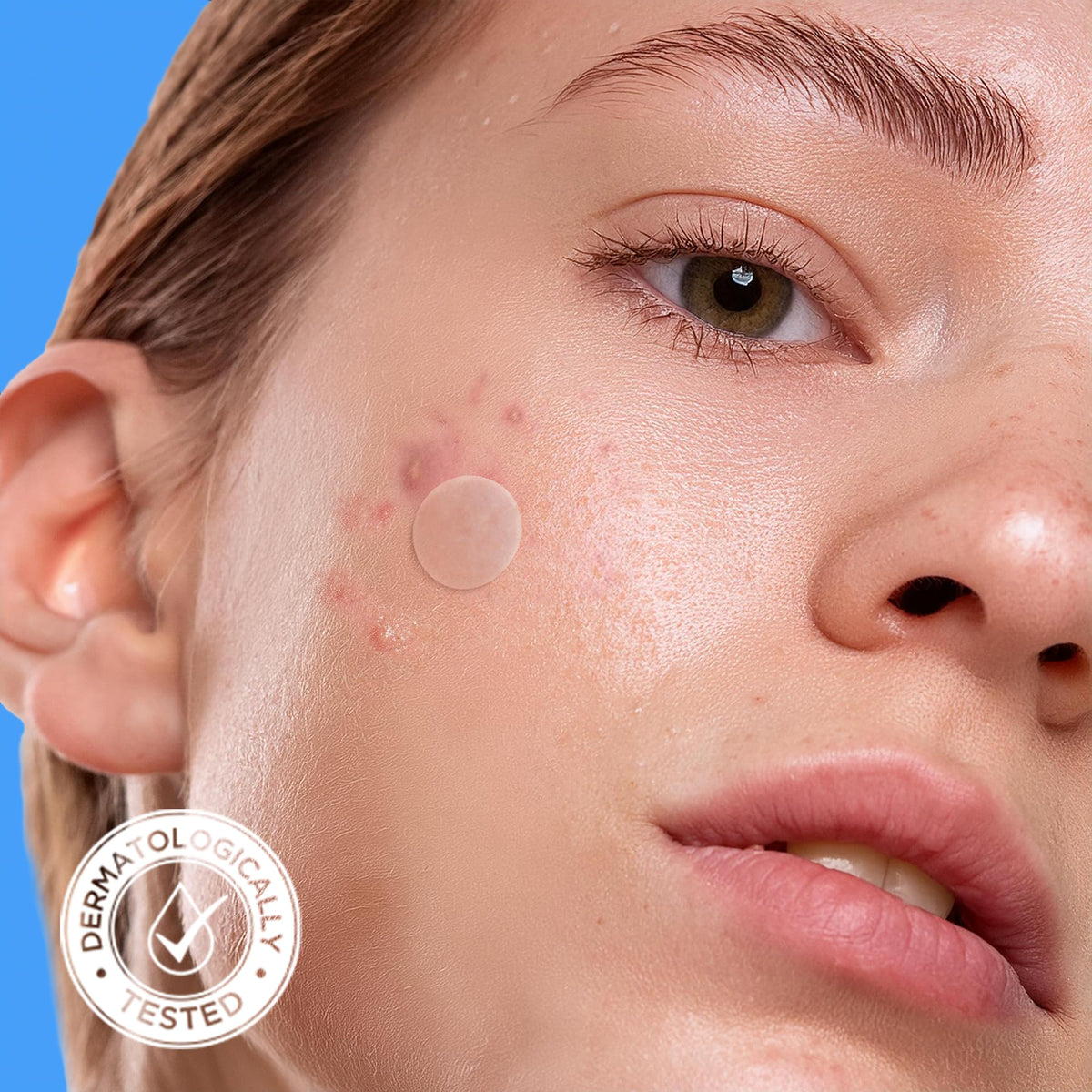 AVARELLE Original Hydrocolloid Acne Pimple Patches for Face 40 Count AVARELLE