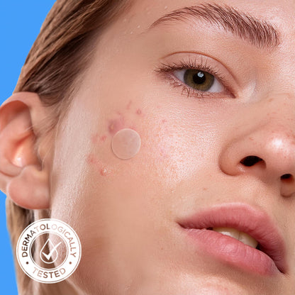 AVARELLE Original Hydrocolloid Acne Pimple Patches for Face 40 Count AVARELLE