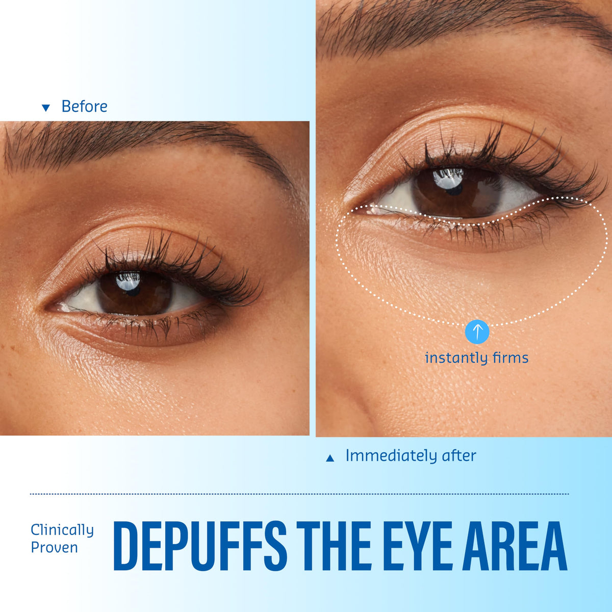belif Aqua Bomb Cooling Eye Gel - Caffeine & Hyaluronic Acid for Puffiness & Hydration, Niacinamide & Vitamin C for Dark Circles, Adenosine & Collagen for Plumping, Korean Skin Care, 0.5 fl oz (15ml) belif