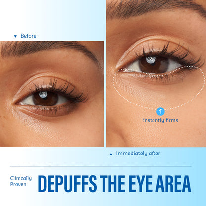 belif Aqua Bomb Cooling Eye Gel - Caffeine & Hyaluronic Acid for Puffiness & Hydration, Niacinamide & Vitamin C for Dark Circles, Adenosine & Collagen for Plumping, Korean Skin Care, 0.5 fl oz (15ml) belif