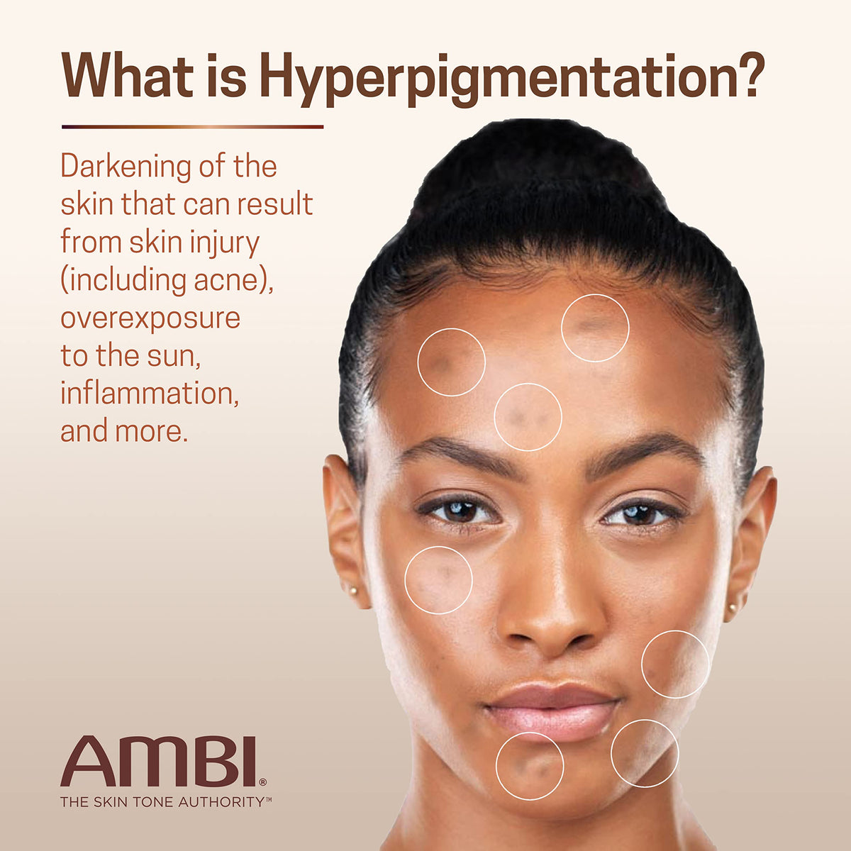Ambi Even & Clear Advanced Fade Cream, Hydroquinone-free, Hyperpigmentation Treatment, Stubborn Dark Spot Corrector, Results In As Little As 2-3 Weeks, Niacinamide, Licorice Root Extract, PHA, 1 Fl Oz Ambi