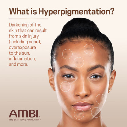 Ambi Even & Clear Advanced Fade Cream, Hydroquinone-free, Hyperpigmentation Treatment, Stubborn Dark Spot Corrector, Results In As Little As 2-3 Weeks, Niacinamide, Licorice Root Extract, PHA, 1 Fl Oz Ambi
