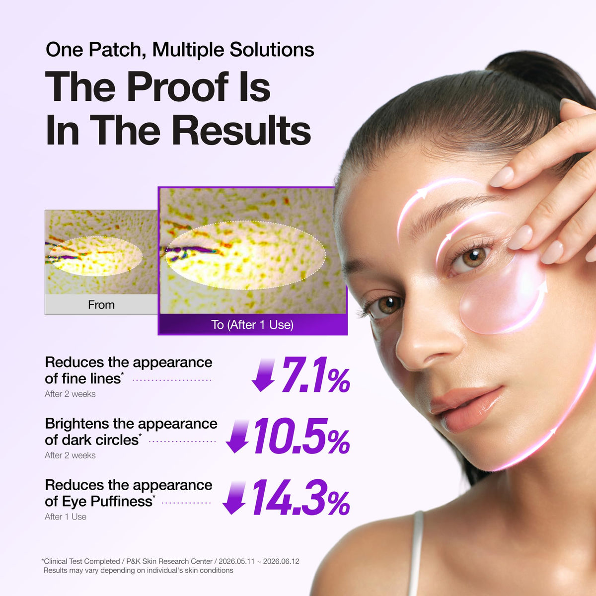 ANUA Retinol Berry Eye Patches, 60 Count ANUA