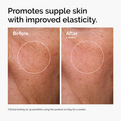The Ordinary Hyaluronic Acid 2% + B5 (with Ceramides), Multi-Depth Hydration Serum for Plumper, Smoother Skin, 1 Fl Oz The Ordinary