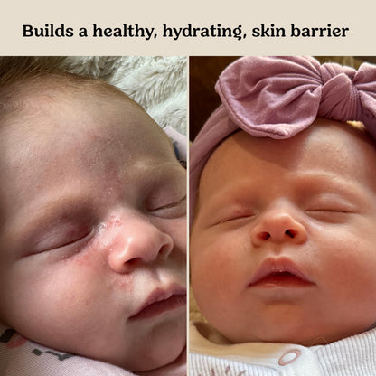 Roe Wellness- Baby Cream Lotion Ointment EWG Verified Non-Toxic Ingredients | Full Body Biome Barrier | Dry Skin, Itch Relief, Moisturizing, All Over Ointment | Toddlers & Kids