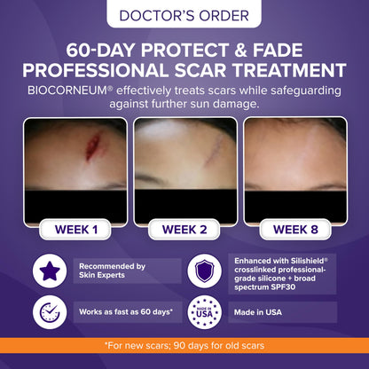 Biocorneum Silicone Scar Gel with SPF 30, Fast-Drying Scar Cream, 10g BIOCORNEUM