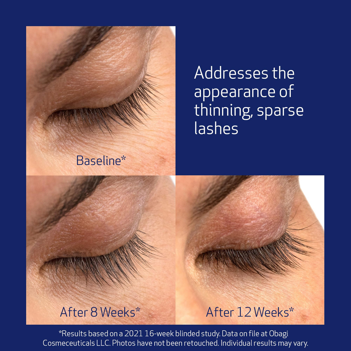 Obagi Nu-Cil Eyelash Enhancing Serum – 0.1 oz Obagi Medical