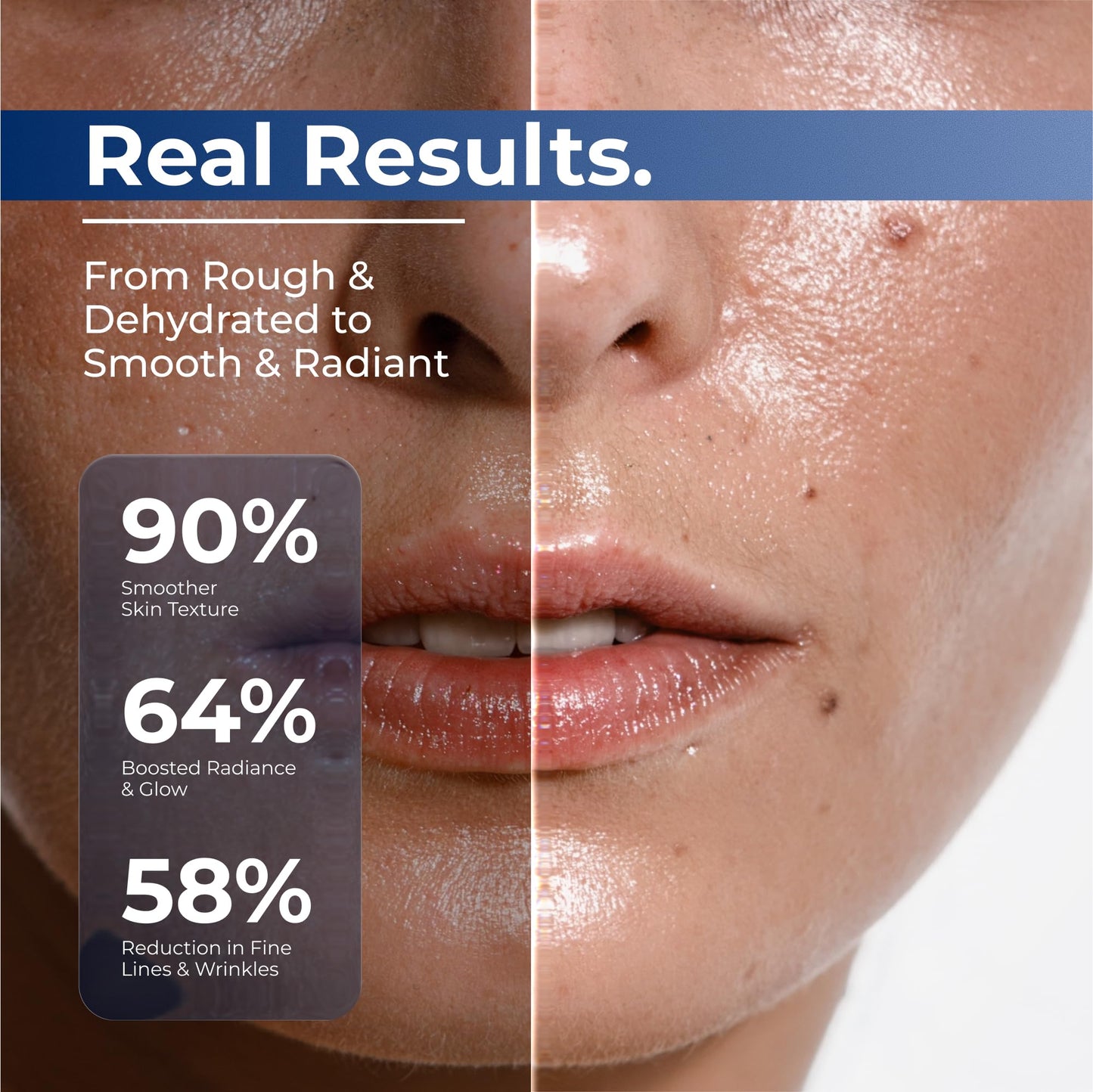 TURMSKIN® Hyaluronic Acid Serum Ampoules [ULTRA HYDRATING VIALS] - 3% Hyaluron Booster for Glass Skin & Anti Aging - 24 Hours Hydration Turmskin