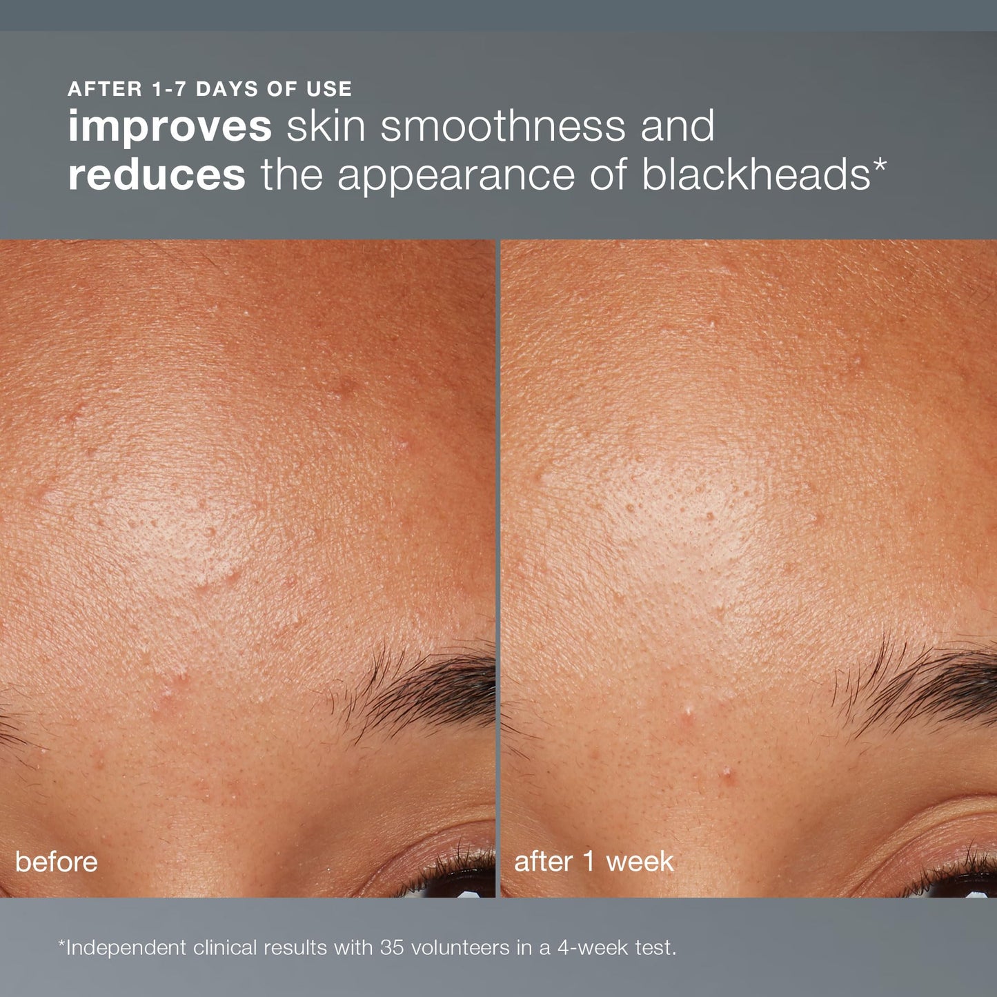 Dermalogica Daily Microfoliant, Face Exfoliator Scrub Powder with Salicylic Acid and Papaya Dermalogica