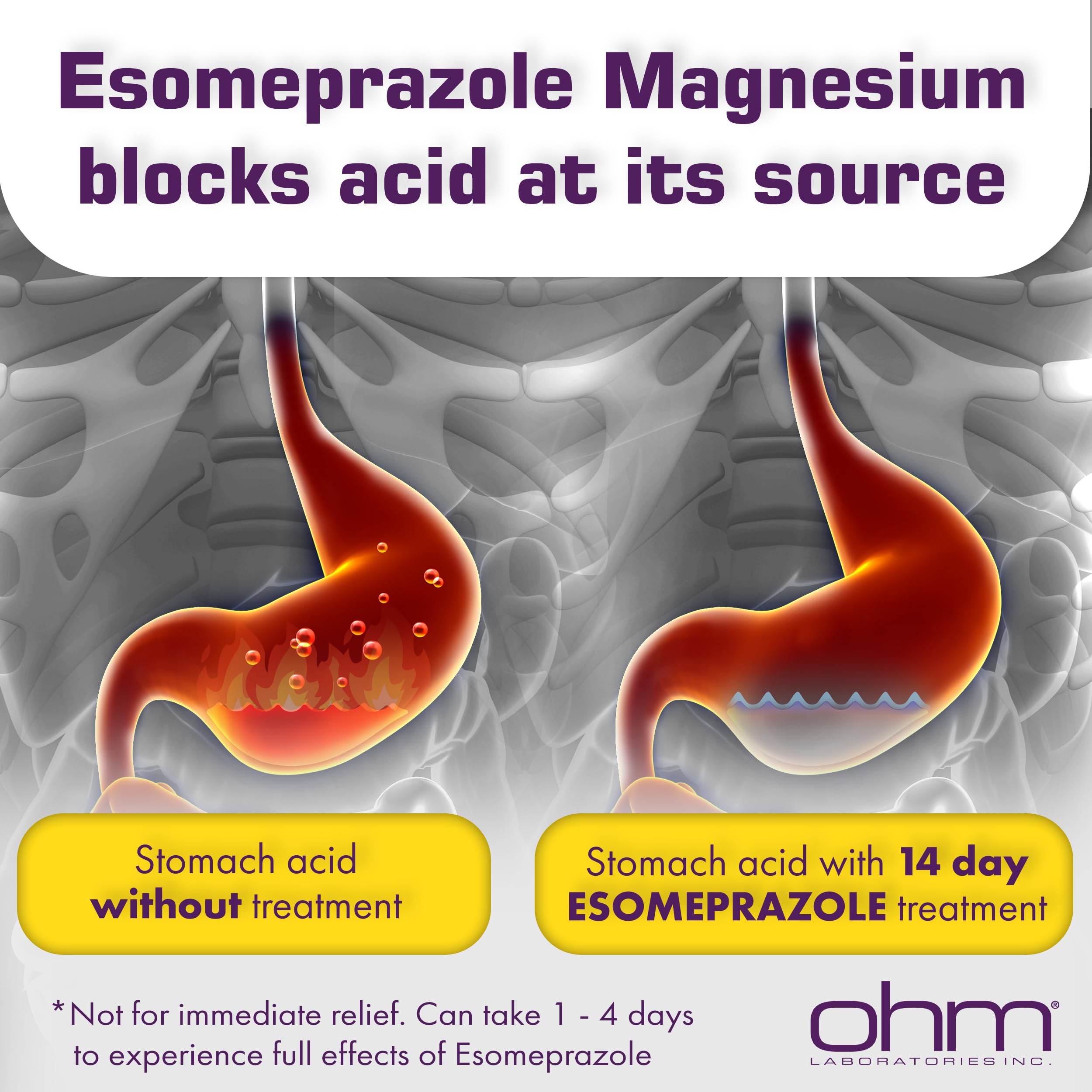 Ohm Esomeprazole Magnesium Delayed Release Capsules 20mg - Frequent Heartburn & Acid Reflux Relief, 24 Hour Chest & Stomach Acid Reducer (6 Weeks of Supply, 42, Count) Ohm buy australia supplements