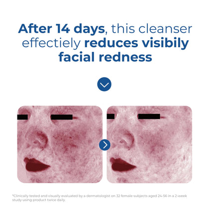EltaMD Skin Recovery Amino Acid Foaming Face Wash, Fragrance-Free, 5 oz EltaMD