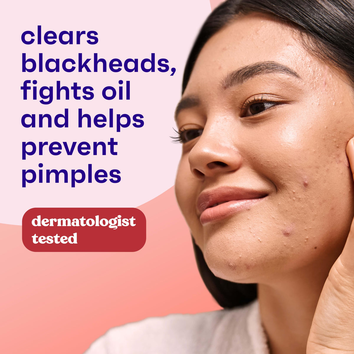 Clean & Clear Essentials Oil-Free Acne Toner, 2% Salicylic Acid, 8 fl oz Clean & Clear
