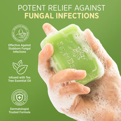 Roycederm Antifungal Bar Soap - Tea tree Oil Soap - Athlete’s Foot Treatment for Jock Itch & Ringworm - Medicated Antifungal Soap with Clotrimazole 1% - Tea Tree Oil Scent, 1 Pack Roycederm