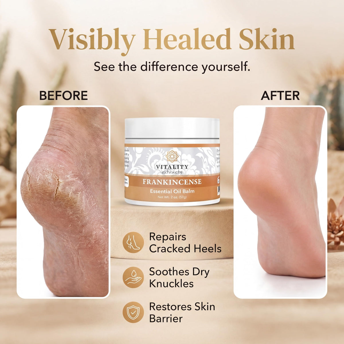 Vitality Extracts Frankincense Essential Oil Balm (2oz) – Boswellia Serrata, Beeswax & Vitamin E, Deep Moisturizing Skin Balm for Dry, Cracked Skin, Soothing & Nourishing for All Skin Types Vitality