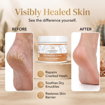 Vitality Extracts Frankincense Essential Oil Balm (2oz) – Boswellia Serrata, Beeswax & Vitamin E, Deep Moisturizing Skin Balm for Dry, Cracked Skin, Soothing & Nourishing for All Skin Types Vitality