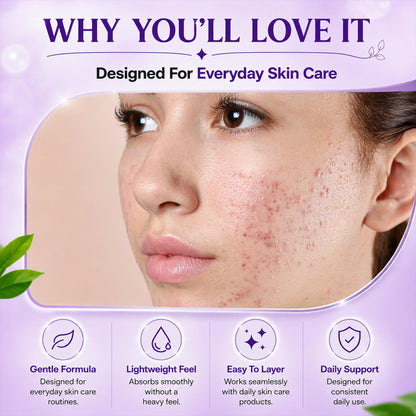 AOBBIY Azelaic Acid Cream for Face, Facial Moisturizer for Smoother-Looking Skin, 1 oz AOBBIY