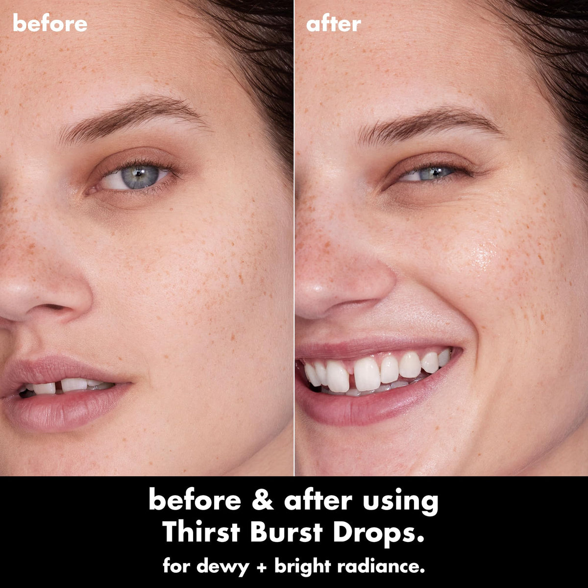 e.l.f. SKIN Thirst Burst Drops, Serum For A Radiant Complexion Instantly & Over Time, Made With Hyaluronic Acid, Vegan & Cruelty-Free e.l.f.