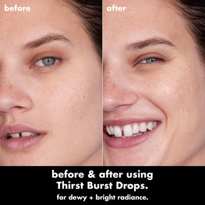 e.l.f. SKIN Thirst Burst Drops, Serum For A Radiant Complexion Instantly & Over Time, Made With Hyaluronic Acid, Vegan & Cruelty-Free e.l.f.