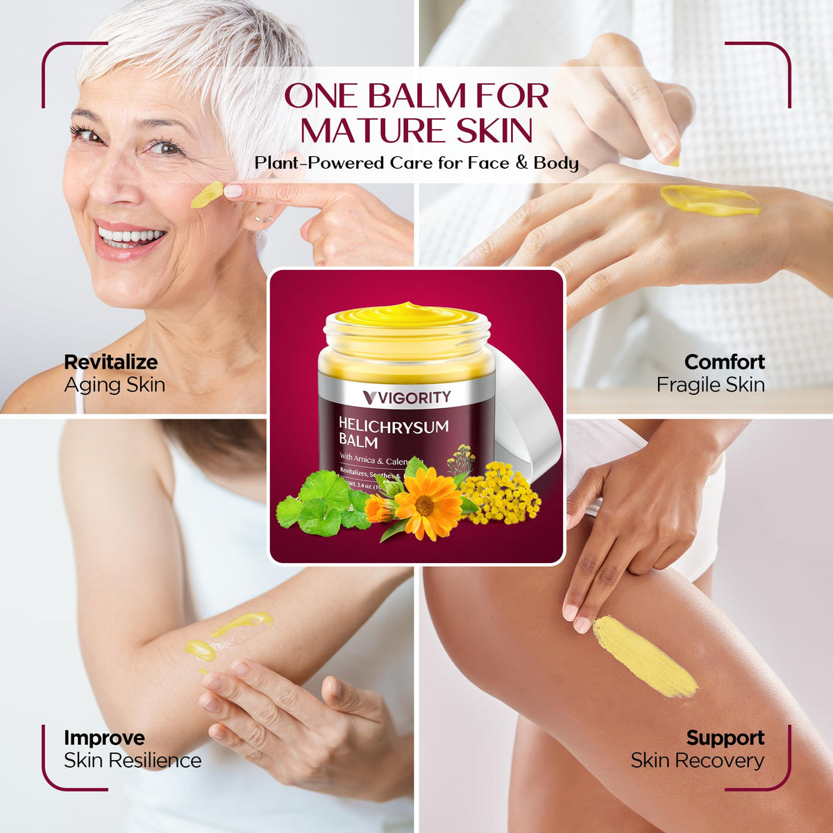 Vigority Helichrysum Balm Soothes & Repairs: Restorative Arnica Cream with Calendula for Fragile, Thin Skin & Bruise-Prone – Moisturizes, Revitalizes & Strengthens Skin Barrier for Adult Seniors 3.4oz Vigority