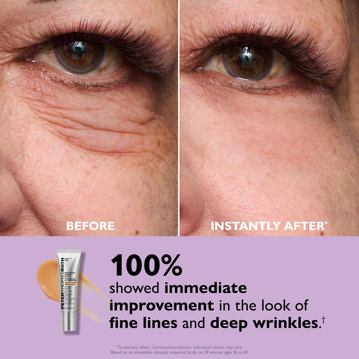 Peter Thomas Roth | Instant FIRMx® Eye Temporary Eye Tightener Easy-Wear Formula | For Firming Under-Eye Bags & Wrinkles Peter Thomas Roth