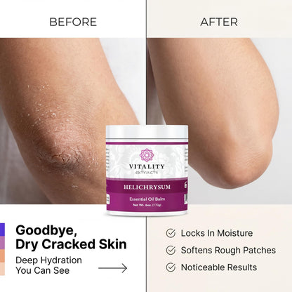 Vitality Extracts Helichrysum Balm - 6oz, Helichrysum Gymnocephalum, Beeswax, Almond Oil, Ultra-Moisturizing, Skin Healing, Full Body Hydration Vitality