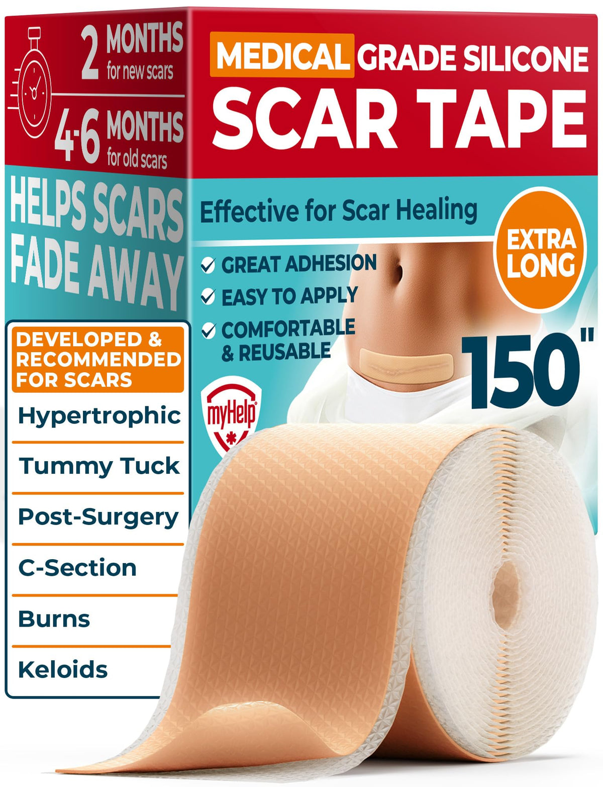 Medical Grade Silicone Scar Tape - 1.6"x150" - Effective Scar Removal MYHELP