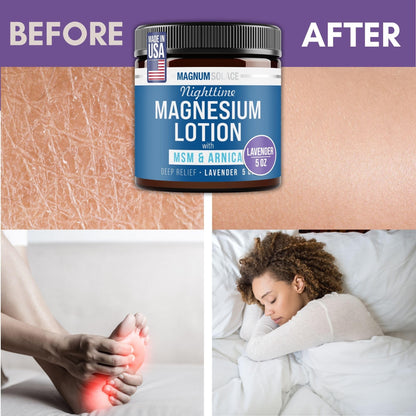 Magnum Solace Nighttime Magnesium Lotion with MSM & Arnica – Highly Concentrated Magnesium for Muscles & Joints – Apply to Legs or Feet Before Bed – Skin-Friendly Magnum Solace