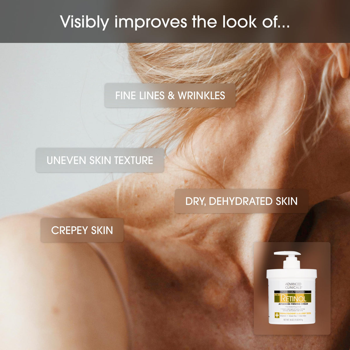 Advanced Clinicals Retinol Body Lotion & Face Moisturizer | Visible Anti Aging Skin Care Retinol Body Cream For Women & Men Targets Look Of Fine Lines, Wrinkles, & Crepe Looking Dry Skin, 16 Ounce Advanced Clinicals