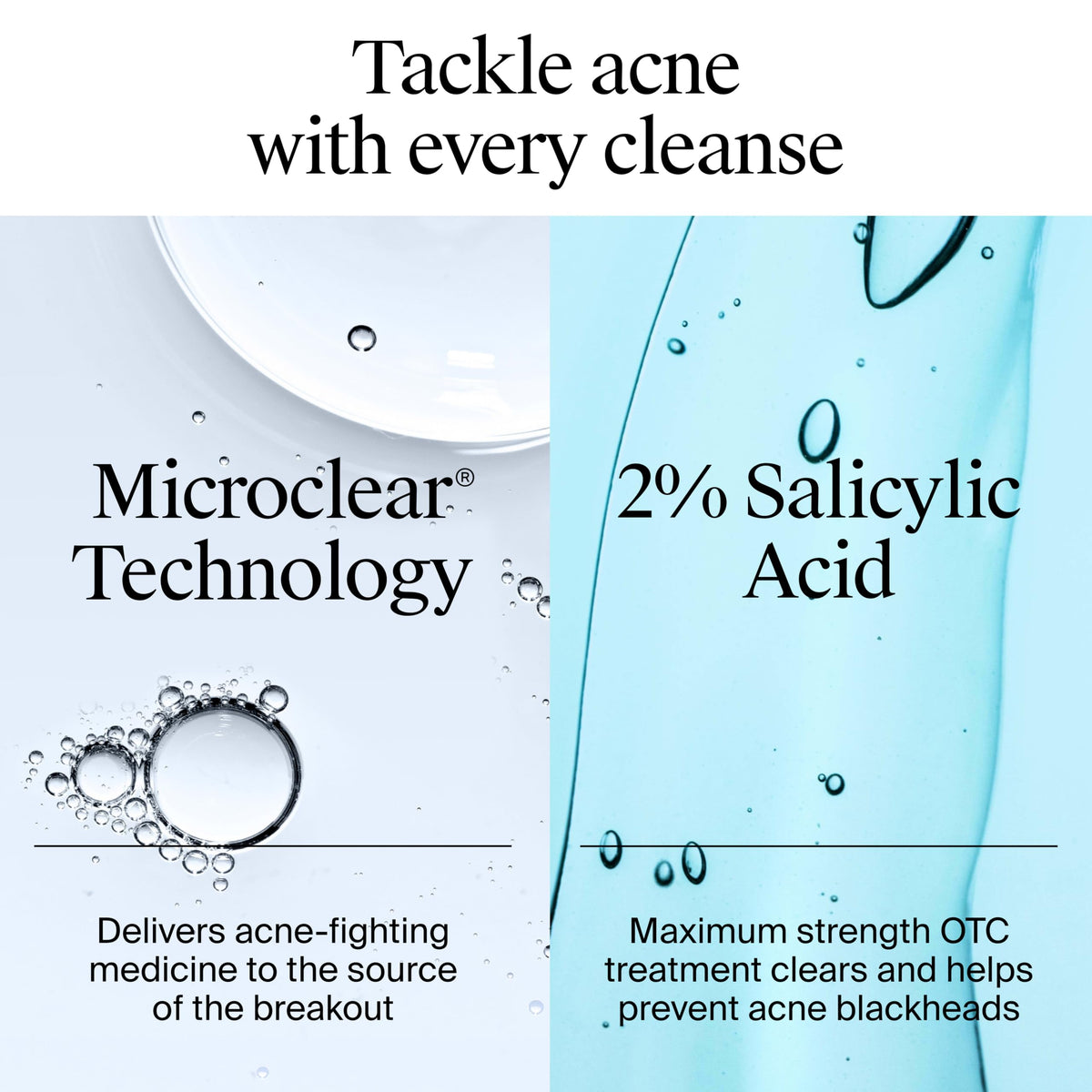 Neutrogena Oil Free Acne Face Wash, 9.1 fl. oz Neutrogena