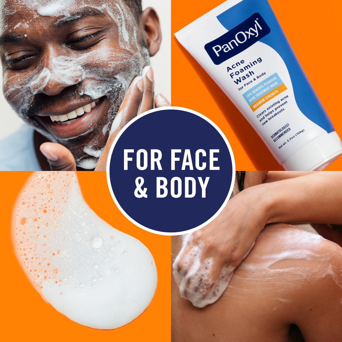 PanOxyl 10% Benzoyl Peroxide Acne Foaming Wash, Maximum Strength, Daily Acne-Fighting Face and Body Cleanser, Face Wash to Clear, Treat and Prevent Acne Pimples and Stubborn Breakouts, 5.5 Oz Tube PanOxyl